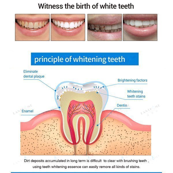teeth whitening pensg8urk